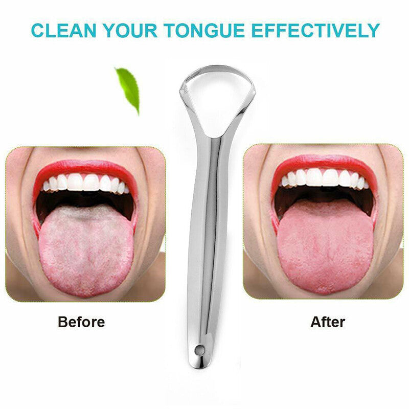 2X Stainless Steel Tongue Tounge Cleaner Scraper Dental Care Hygiene Oral Mouth