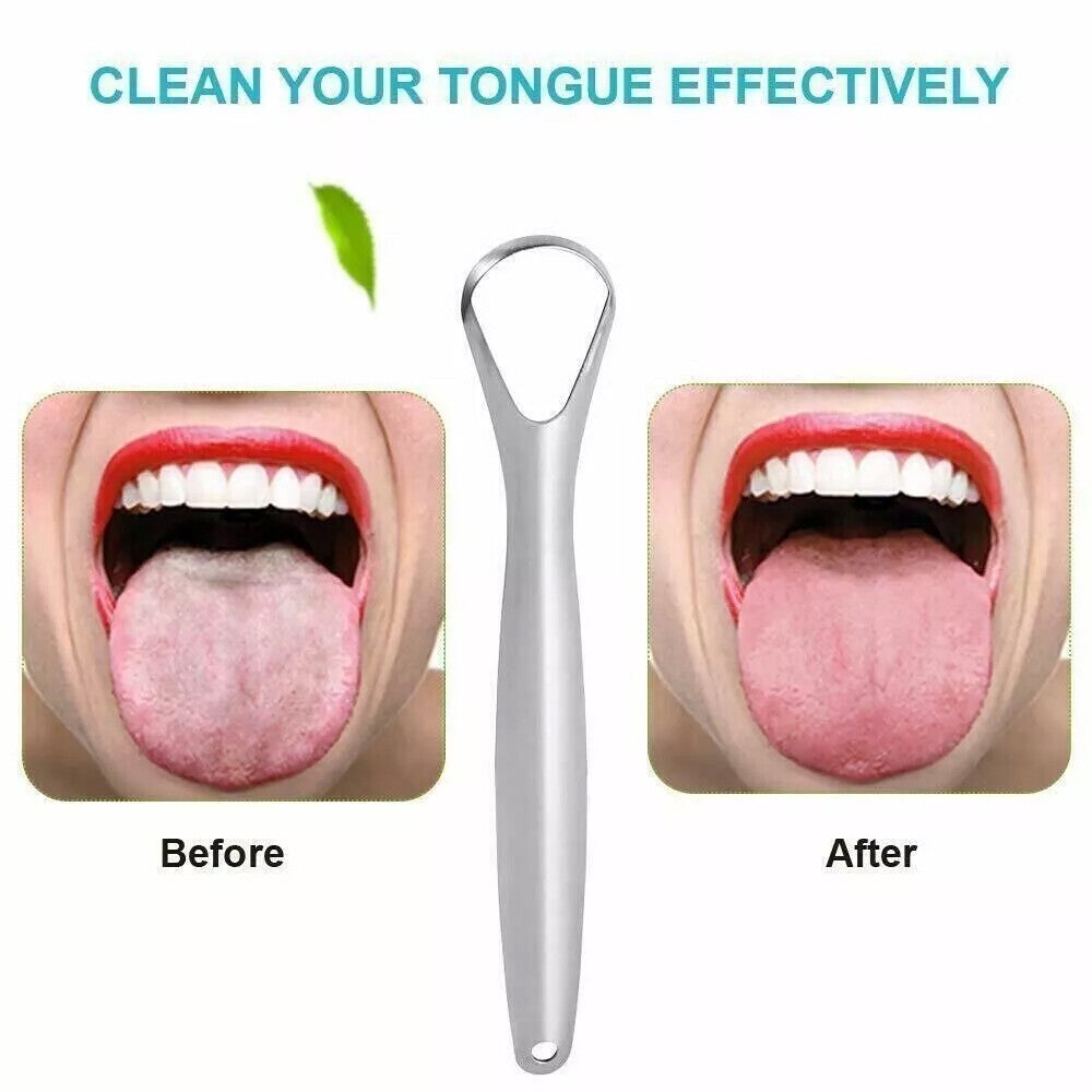 2X Stainless Steel Tongue Tounge Cleaner Scraper Dental Care Hygiene Oral Mouth
