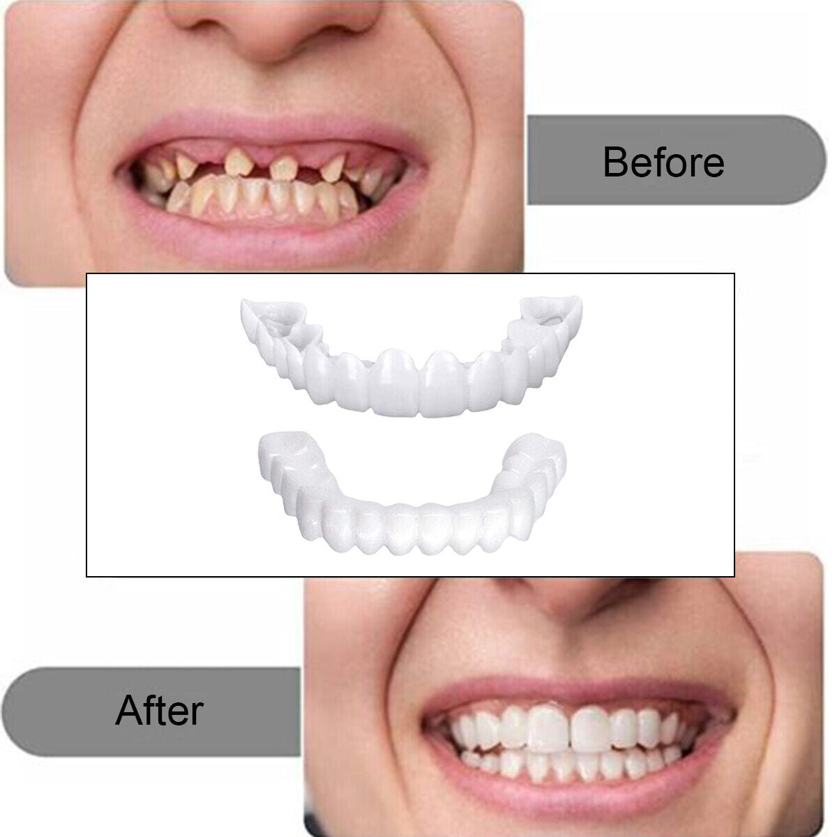 Smile Snap On False Teeth Upper Lower Dental Veneers Dentures Tooth Cover Set