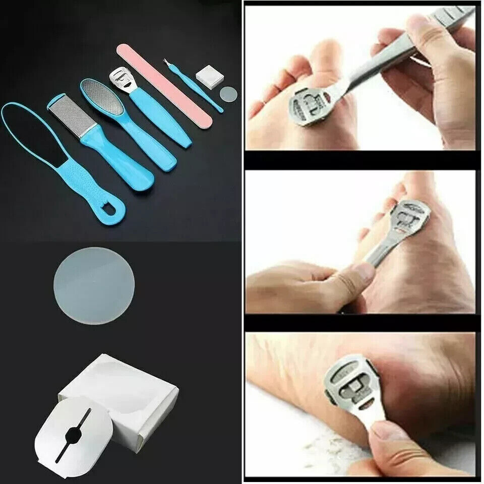 8 Pcs Foot Rasp File Scrubber Hard Dead Rough Skin Callus Remover Set Pedicure